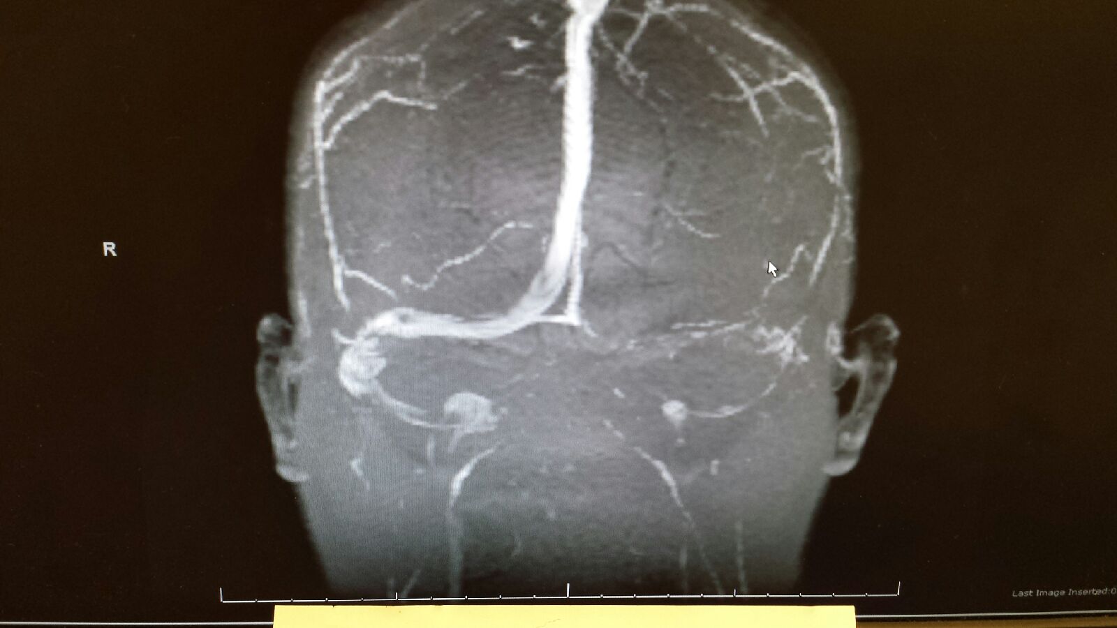 THE picture - brain scan.jpeg